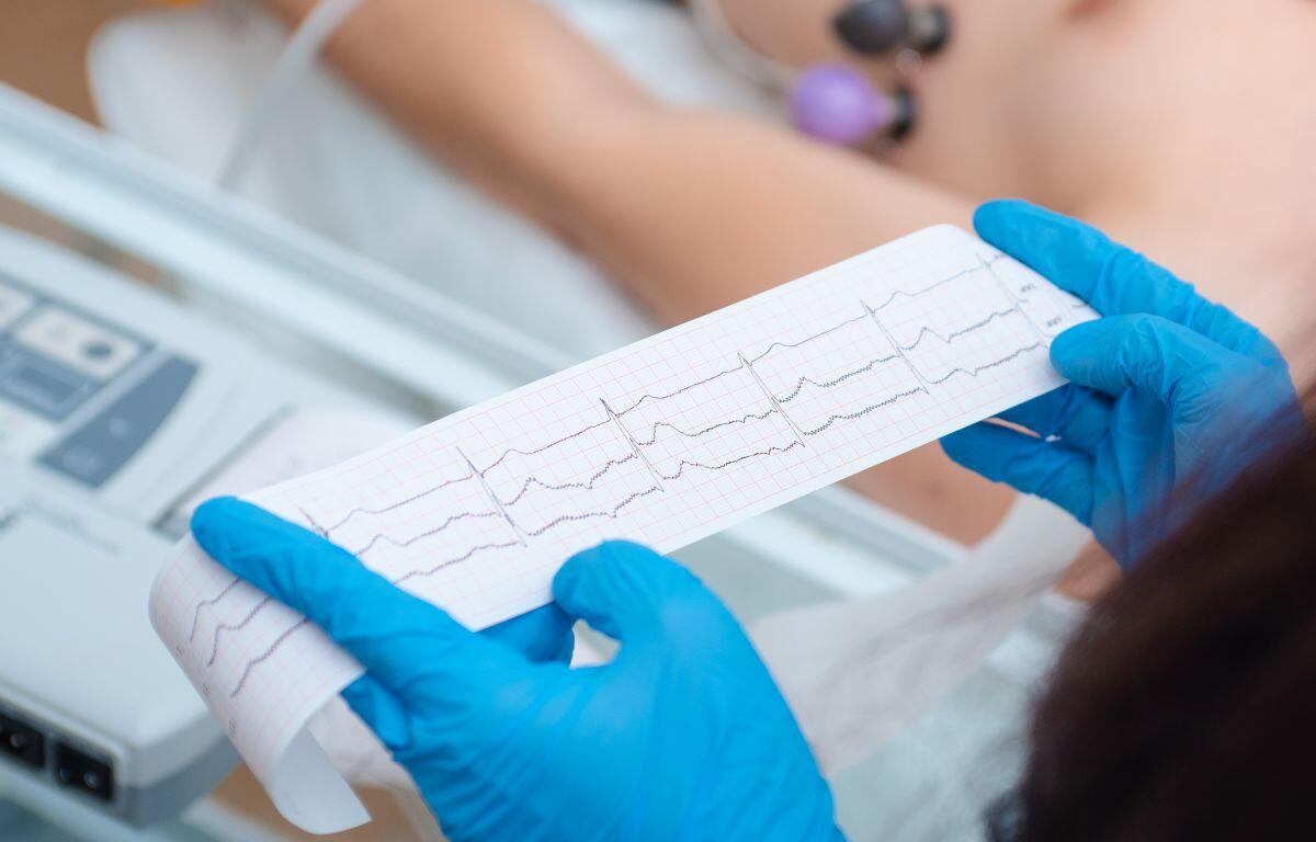 Heart rhythm strip