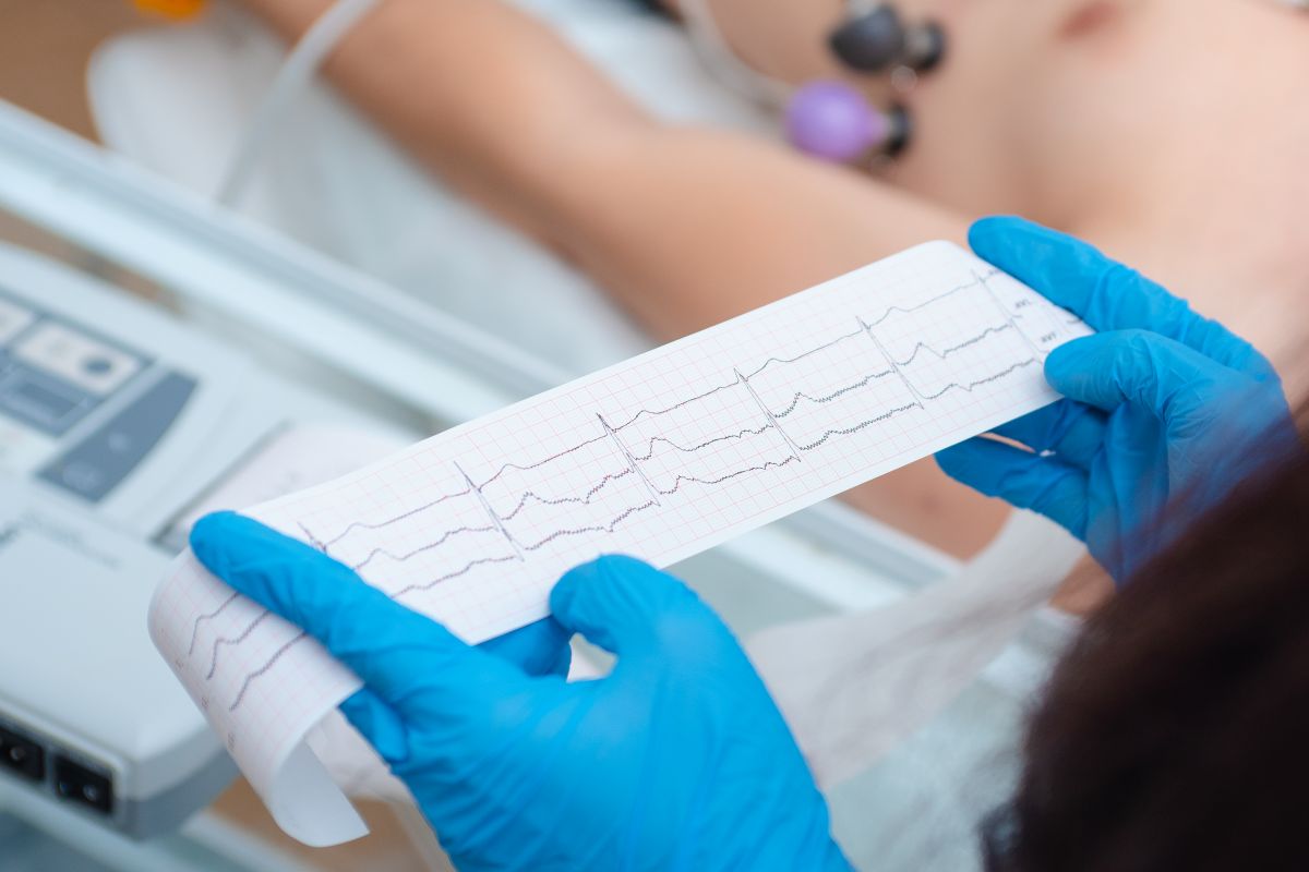 Heart rhythm strip