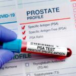 PSA test