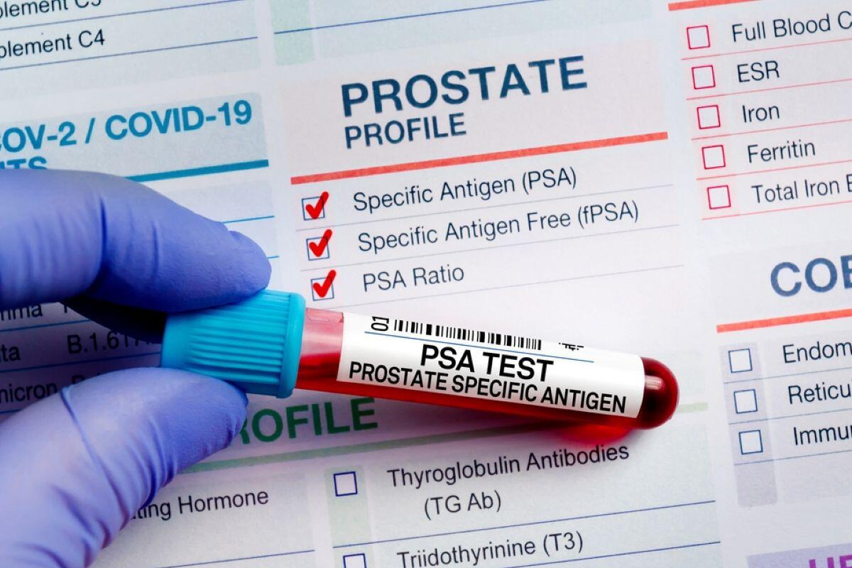 PSA test