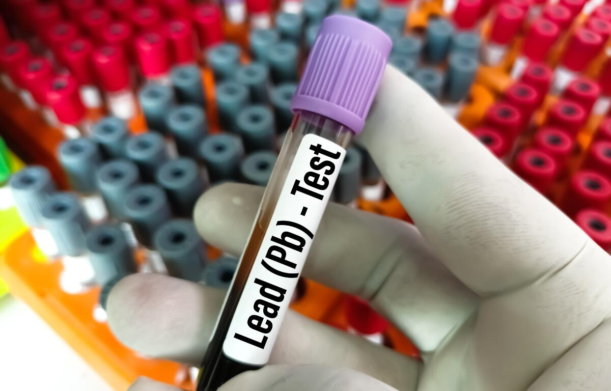 A vial of blood being tested for lead exposure
