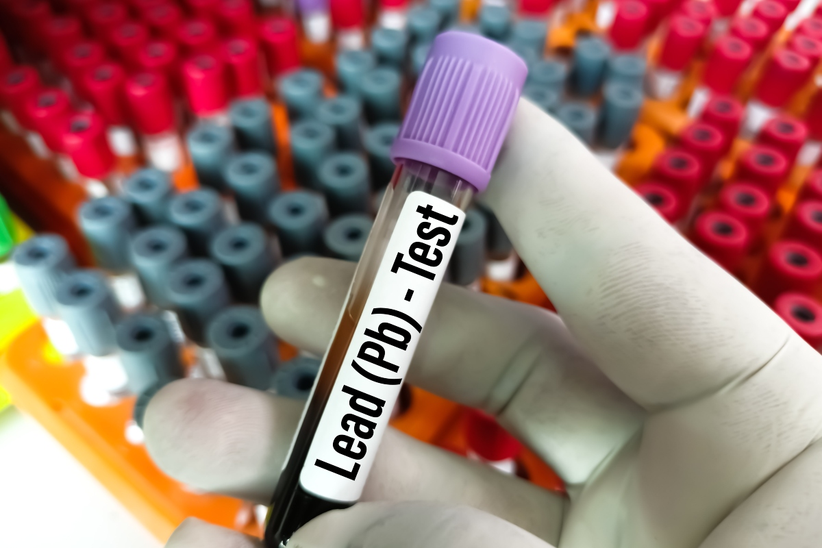 A vial of blood being tested for lead exposure