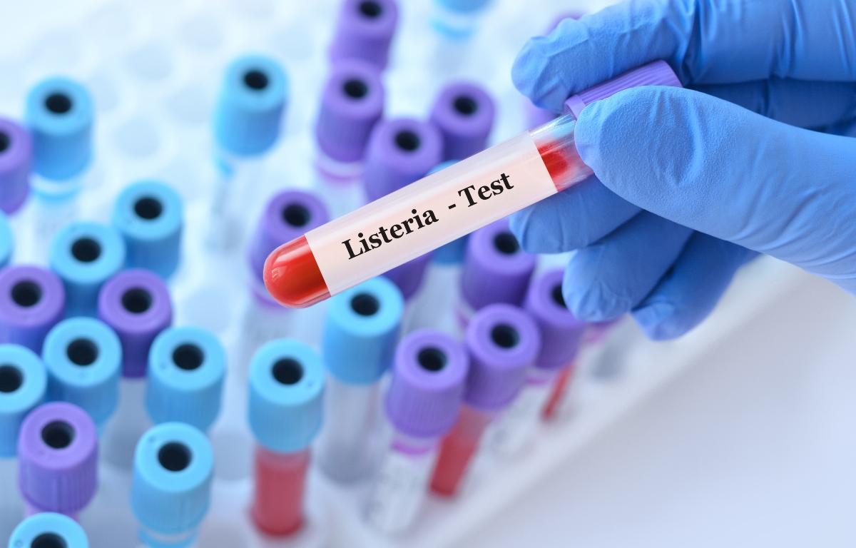 Listeria test