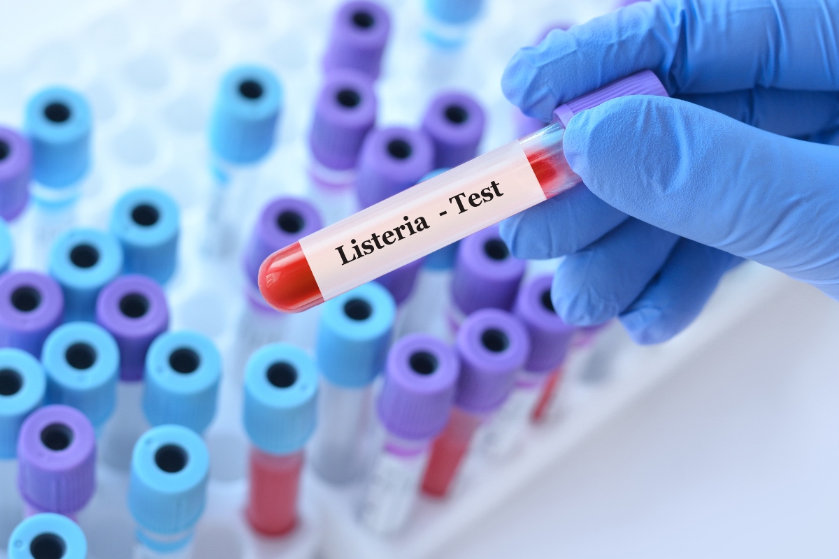 Listeria test