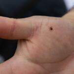 A lone star tick crawls on southern Illinois University zoology professor Agustín Jiménez’s hand on April 13, 2026, in Thompson Woods in Carbondale, Illinois. (Photo by Riley Sembler)