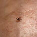Tick Walking on Human Skin Seeking Place to Feed on Blood