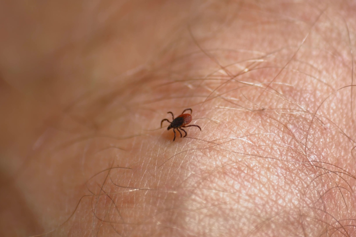 Tick Walking on Human Skin Seeking Place to Feed on Blood