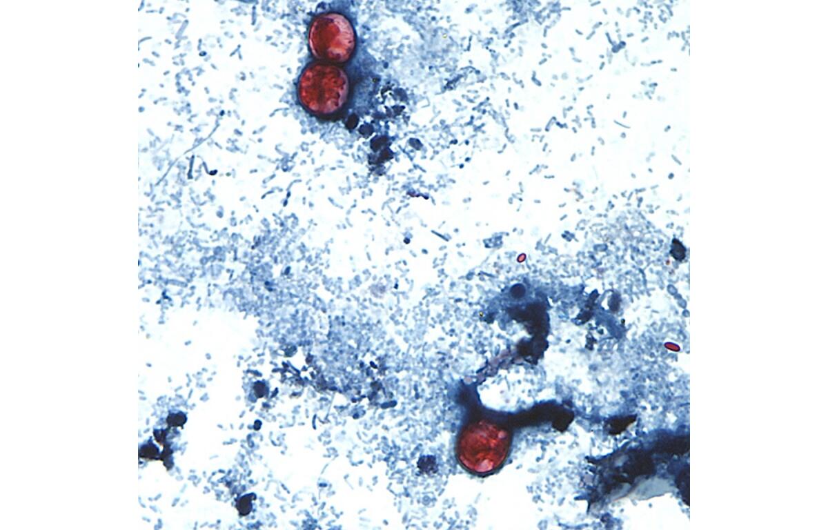 Microscopic view of a stained slide showing red blood cells among blue-stained tissue cells.