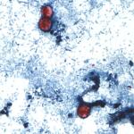 Microscopic view of a stained slide showing red blood cells among blue-stained tissue cells.