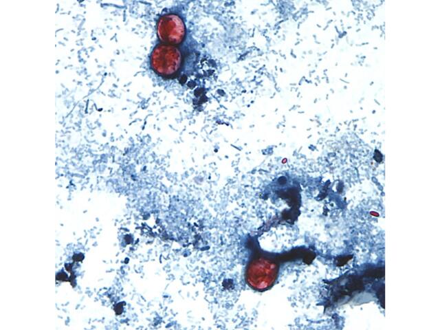 Microscopic view of a stained slide showing red blood cells among blue-stained tissue cells.