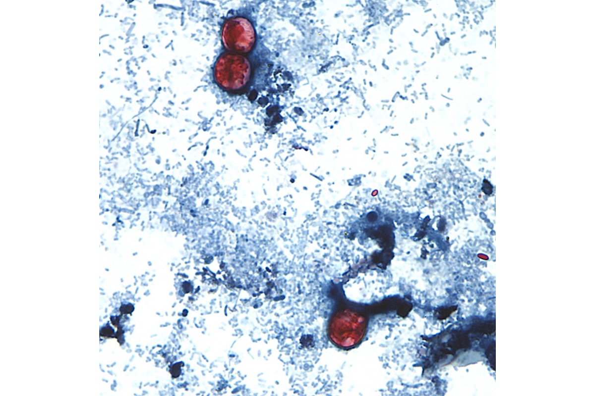 Microscopic view of a stained slide showing red blood cells among blue-stained tissue cells.