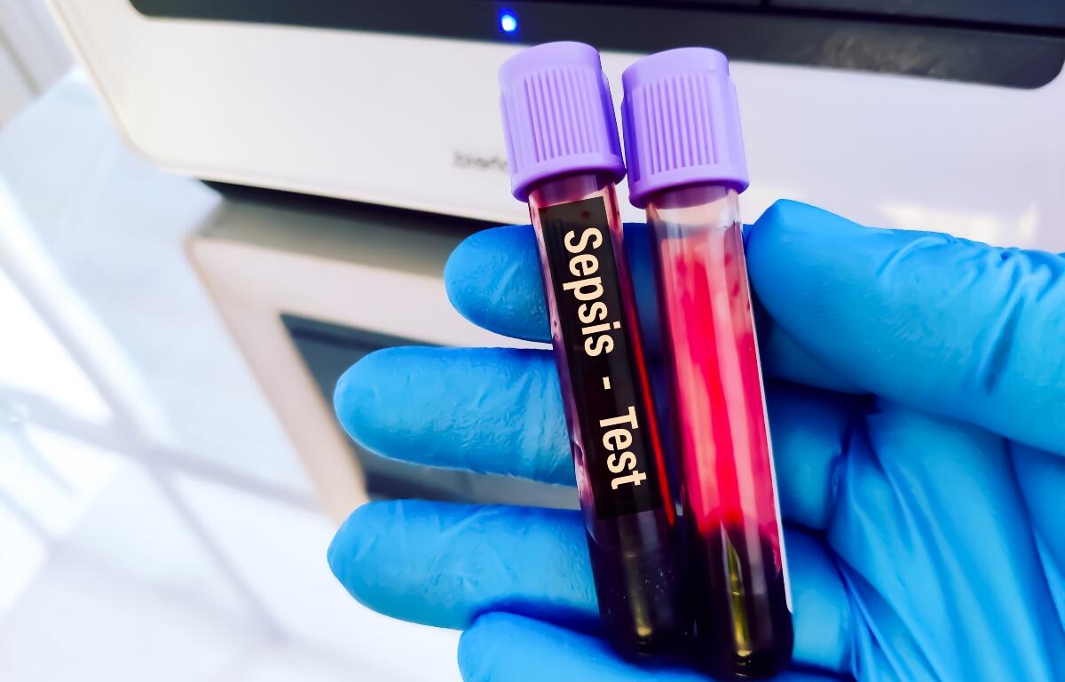 Gloved hand holding two blood sample tubes labeled 'Sepsis - Test' with purple caps in a lab setting