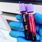 Gloved hand holding two blood sample tubes labeled 'Sepsis - Test' with purple caps in a lab setting