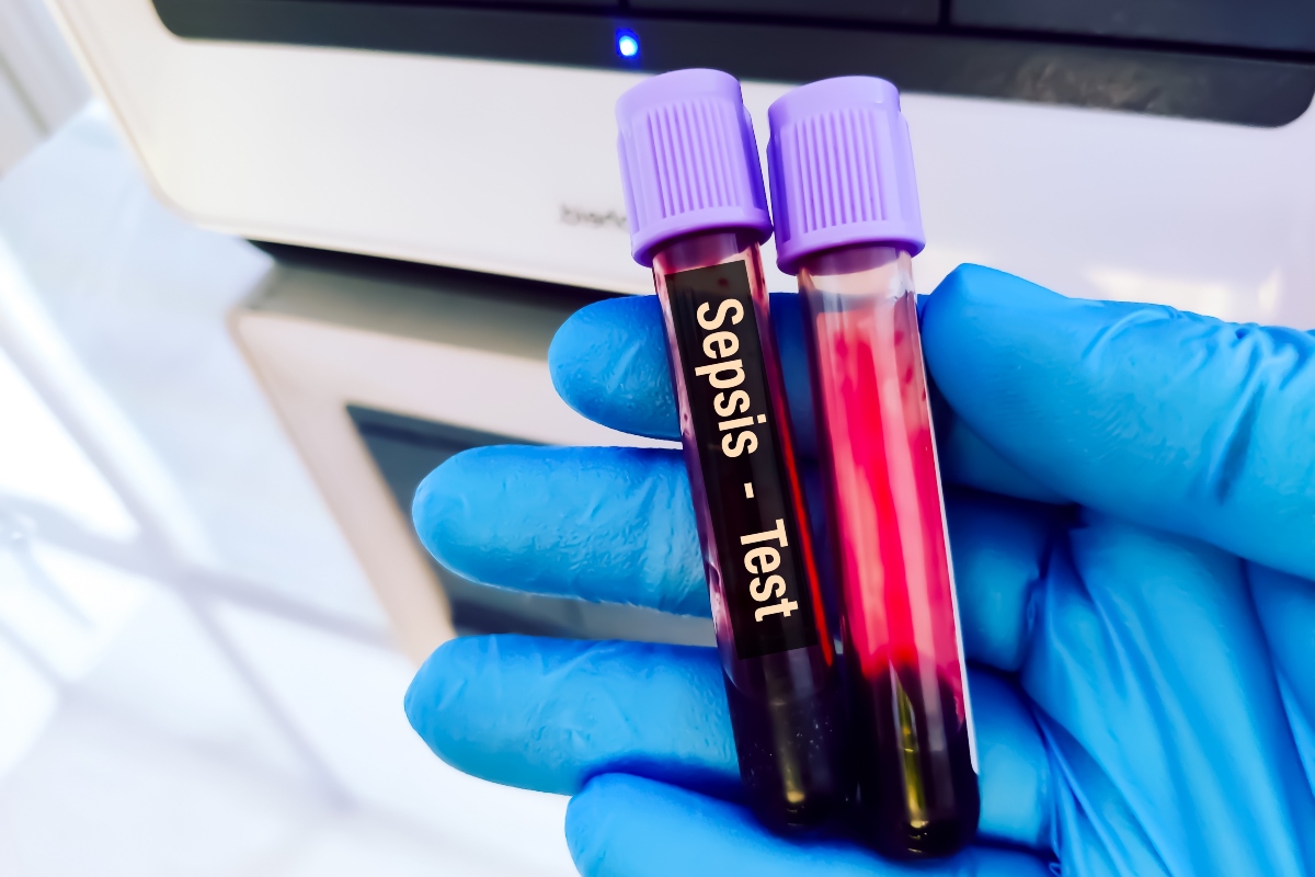 Gloved hand holding two blood sample tubes labeled 'Sepsis - Test' with purple caps in a lab setting