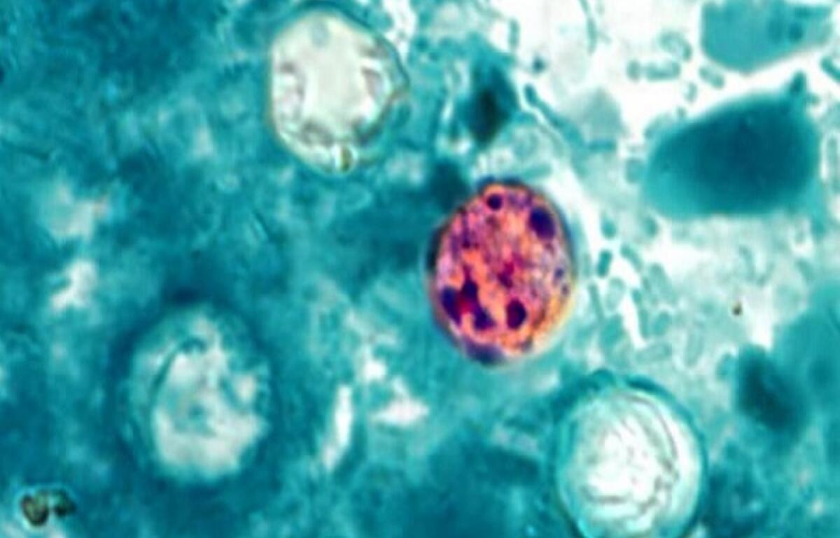CDC Cyclospora