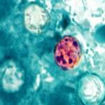 CDC Cyclospora