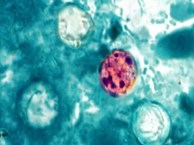 CDC Cyclospora
