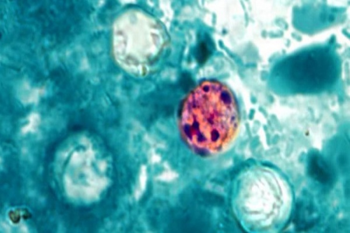 CDC Cyclospora